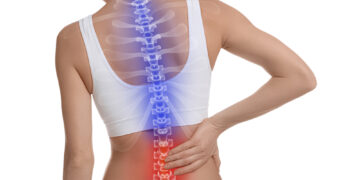 image of woman with back pain - the value of the McKenzie method