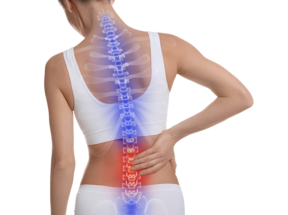 image of woman with back pain - the value of the McKenzie method